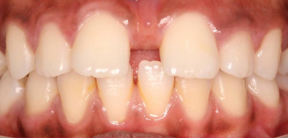 Before & Afters