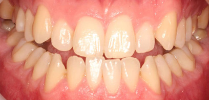 Before & Afters