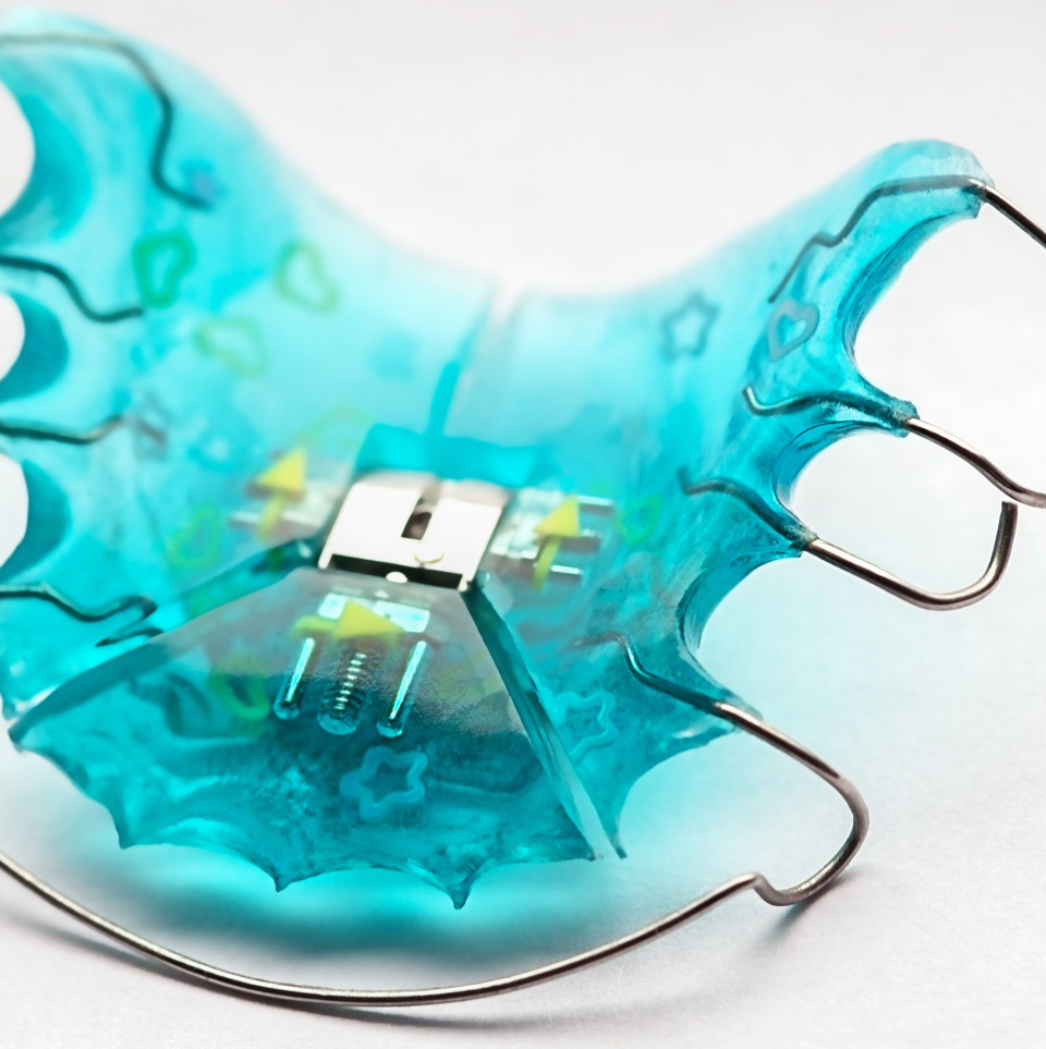 Removable Appliances Simple Tooth Movement Links Orthodontics Removable Appliances Simple Tooth Movement Links Orthodontics