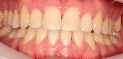 Before & Afters